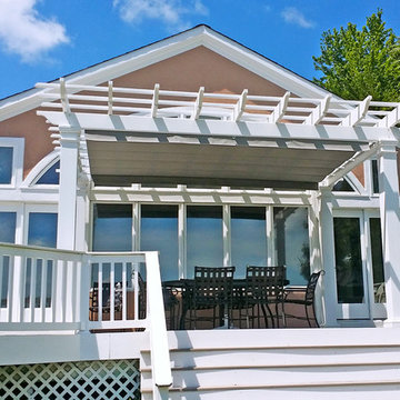 Retractable Shade, Gambrills