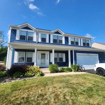 Siding Installation | Siding Contractors near Chicago