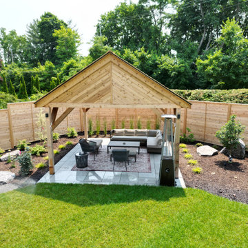 Backyard 25