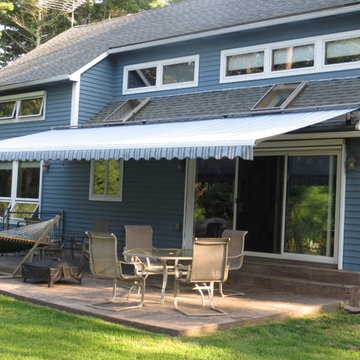 Motorized Retractable Awning