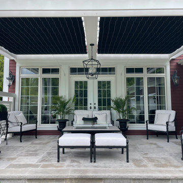 Retractable Canopy Side -by-Side and PanelCraft Patio Cover