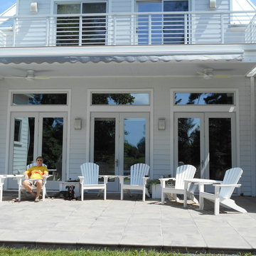 Motorized Retractable Awning