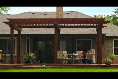 Pergolas