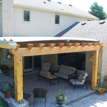 Retractable Roof, Rochester Hills