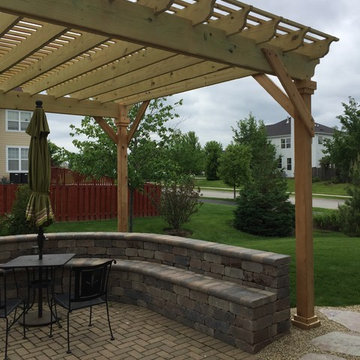 Detached Pergola by Elgin, IL Pergola Builder