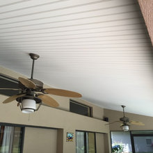 pergola