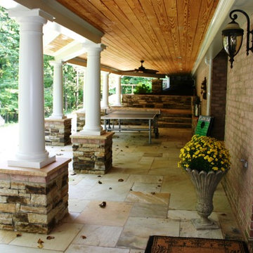 Running Springs Back Landscape Renovation