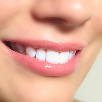 White Light Smile