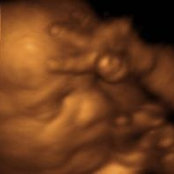 A New Conception's photo
