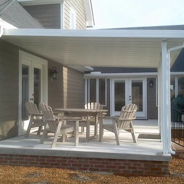 Aluminum Patio Construction in Foster City, CA