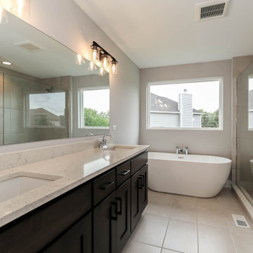 Modified Laguna I | Reserves of Dunmoor Estates Plainfield, IL
