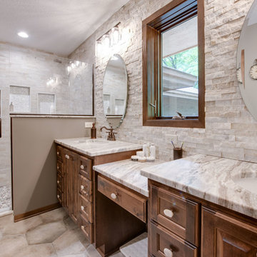 Hillside Remodel