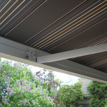 Side by Side Eclipse Premier Retractable Awnings