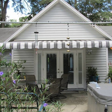 Motorized Retractable Awning