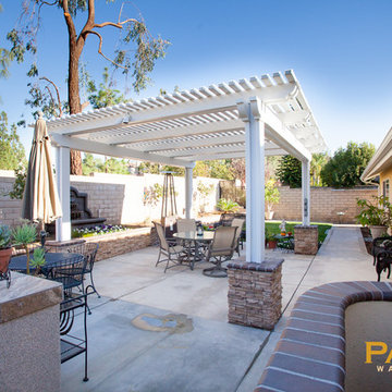 Elitewood Lattice Patio Covers
