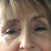 Nan Hittmeiers billede