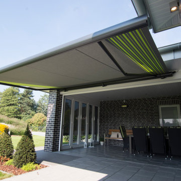 Motorized Retractable Awnings