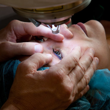 Best Lasik Chicago IL - Kraff Eye Institute (312) 444-1111