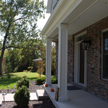 Herringbone Vinyl Siding | Olivette, MO