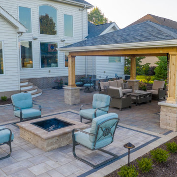 Medina Structure, Fireplace, Unilock Patio and Landscaping