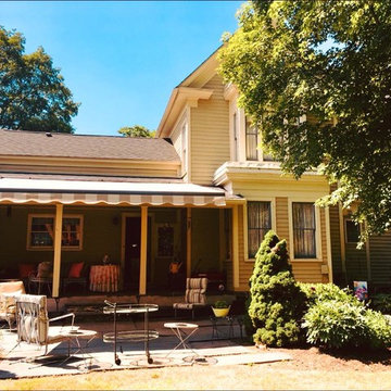 Motorized Retractable Awning