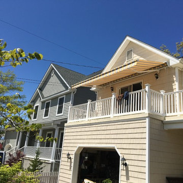 Retractable Awning