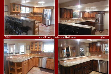 Refacing Before / After