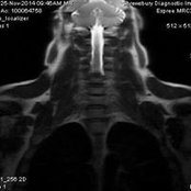 Patrick Toland's photo