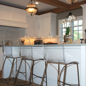 Upper Arlington renovation- before & after