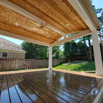Big Time Backyard