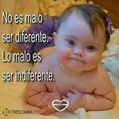 Sindrome Down's photo