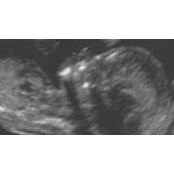 Lindsay Fox's photo
