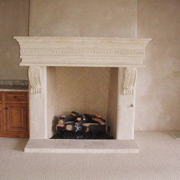 Beautiful project with several fireplace surround styles