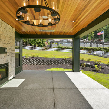 Parthenon | Bellevue