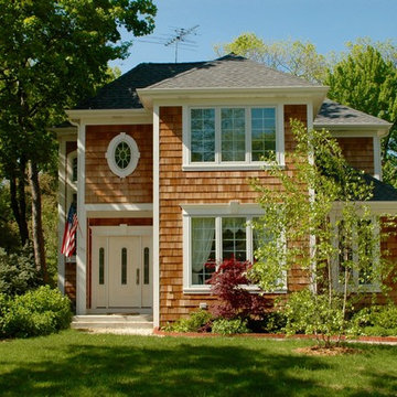 Winnetka, IL Cedar Siding Exterior Remodel