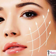 Are you looking for Thread Lift treatment in Singapore