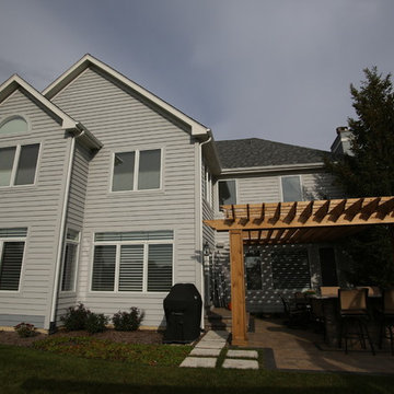 Exterior and Interior Remodel in Naperville, IL