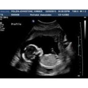 Presley Johnstones billede