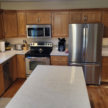 Refacing