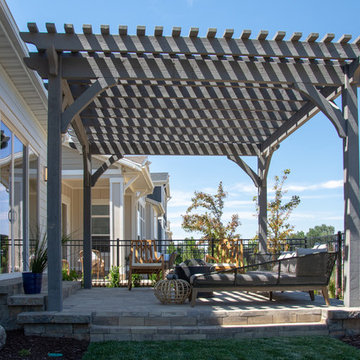 Lounge Size | Backyard DIY Pergola Kit