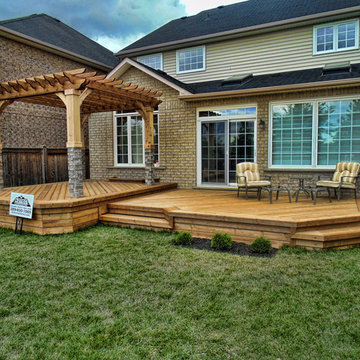 Deck with Pergola in Oshawa, Ontario