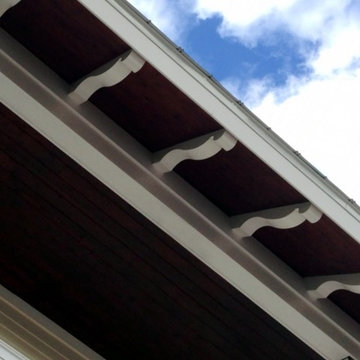 Builder Brackets