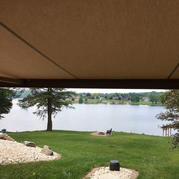 Retractable Awnings/ Aluminum Awnings/Sunshades