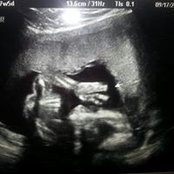 Brittany Allweil's photo