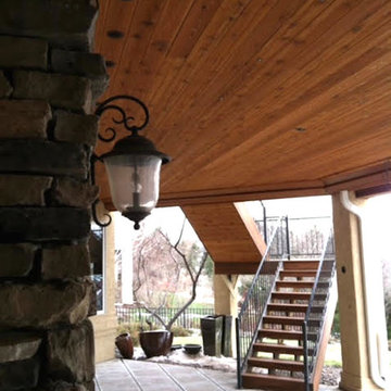 DRY-B-LO Concealed system