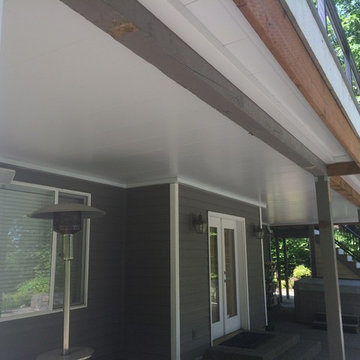 Bellevue Deck Resurface & Undercover System