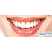 Foto von Beaming-White Trim