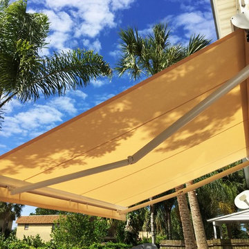 Retractable Awning - Private Residence (Atlantic Beach)
