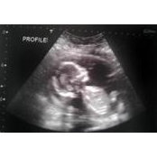 Jen Peterson's photo