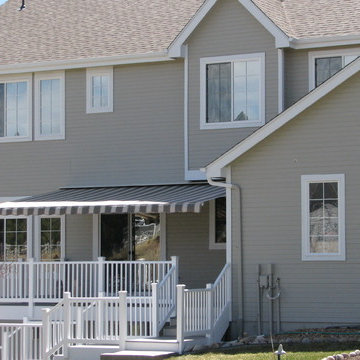 Retractable Awning - Littleton